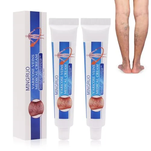 MINGRUO 2Pcs Krampfadern Creme, Krampfader-Creme, Varicose Veins Cream, Creme gegen Besenreiser, Veins Krampfadern Creme, Krampfadern und Besenreiser Entfernen