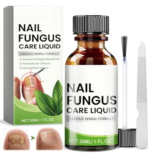 30ml Fußnägel Behandlung, Nagelpflege für Fußnägel, mit Nagelfeile, Schutz & Stärkung brüchiger Nägel, Spendet Feuchtigkeit trockener Nagelhaut, Nail care, Nail Repair