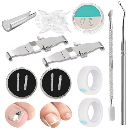Produktbild Pcs Nagelspange FußNäGel,Eingewachsene ZehennäGel Set,Zehennagel Eingewachsen,Nagelspange FußNäGel,Zehennagel Korrektur,Ingrown Toenail,Zehennagel Spange,Nagelspange 152