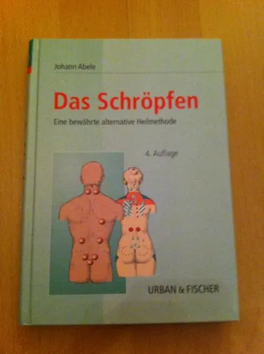 Produktbild Das Schröpfen