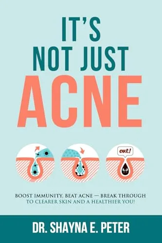 It's Not Just Acne: Boost Immunity, Beat Acne
