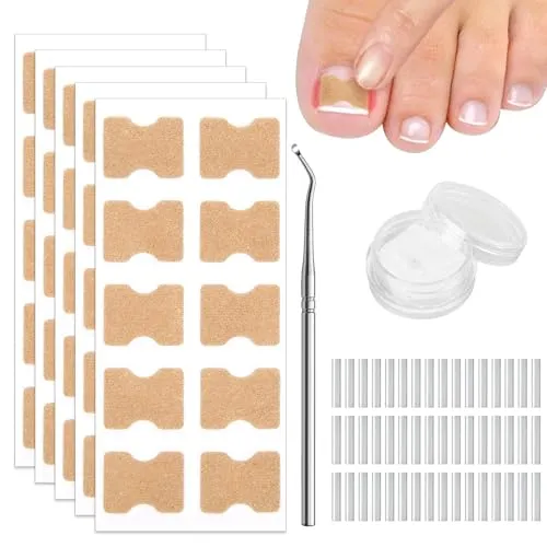 Set zur Korrektur eingewachsener Zehennägel – 101 Teile
