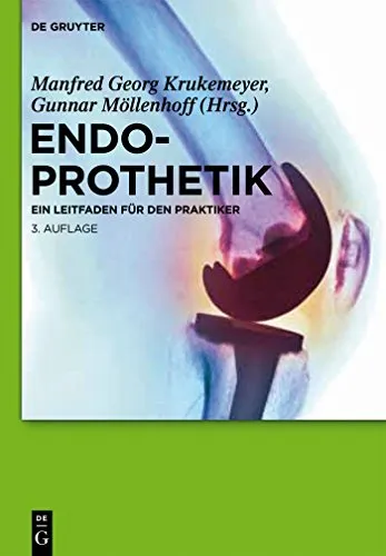 Endoprothetik: Ein Leitfaden für den Praktiker - Chirurgie: Umfassender Leitfaden zur Endoprothetik, ideal für Praktiker zur Verbesserung der Patientenversorgung und OP-Techniken.