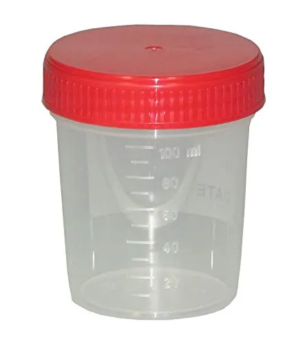 Fa.ars 20 Urinbecher 125 ml Probebecher mit Deckel Urinprobenbecher Schraubdeckel