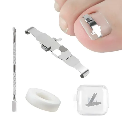 Produktbild Eingewachsene Zehennägel Set – Edelstahl Nagelspange für Pediküre
