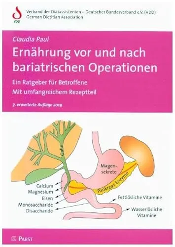 Ernährung vor und nach bariatrischen Operationen: Ein Ratgeber für Betroffene - Ernährungsratgeber mit umfangreichem Rezeptteil, unterstützt Betroffene bei der optimalen Ernährung vor und nach bariatrischen Eingriffen.