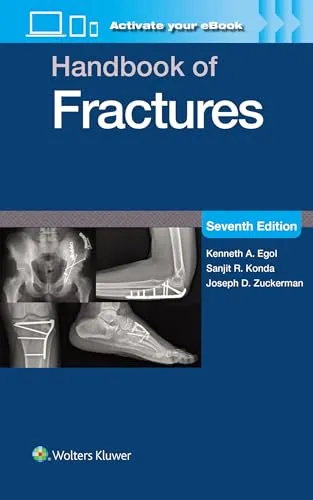 Handbook of Fractures: Mit Online-Dateien
