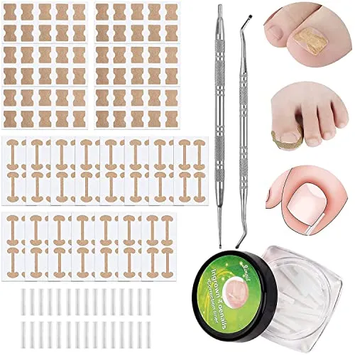 Stücke Eingewachsene Zehennägel Set Zehennagel Korrektur Patch, Zehennagel Korrektur Pflaster, Eingewachsener Zehnagel Fusspflege Set Professionell für Paronychie Eingewachsene Fußnägel 152