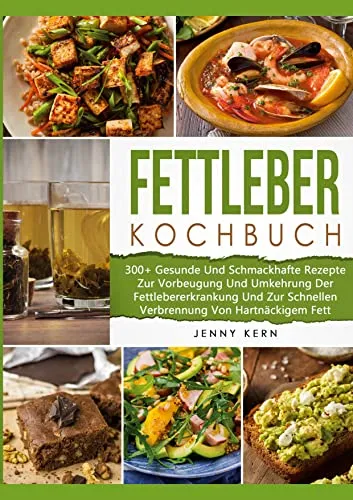 Fettleber Kochbuch: 300+ Gesunde Rezepte zur Vorbeugung