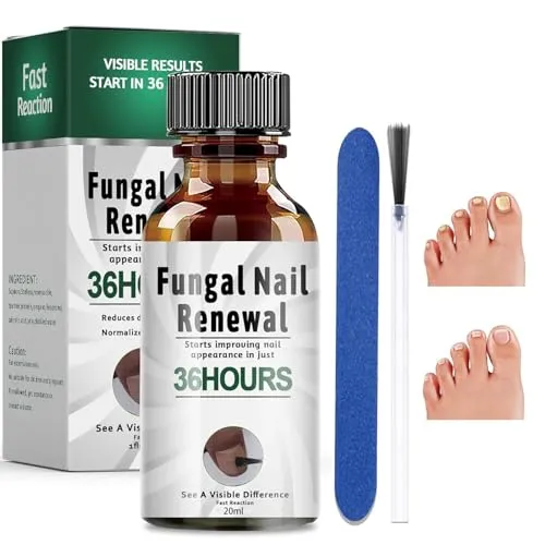 20ml Nagelpflege Pflegend, Nagelpflegeöl, Fingernägel und Fußnägel für Nail care, Nägel Reparatur