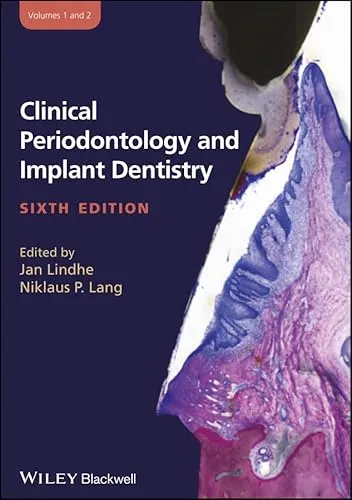 Clinical Periodontology and Implant Dentistry, 2 Pts.: 2 Volume Set