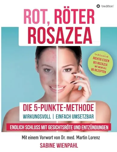 ROT RÖTER ROSAZEA: Die