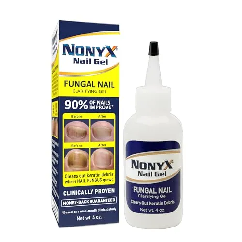 Xenna All Natural nonyx Nail Gel, für Zehennägel und Fingernägel – 4 Oz