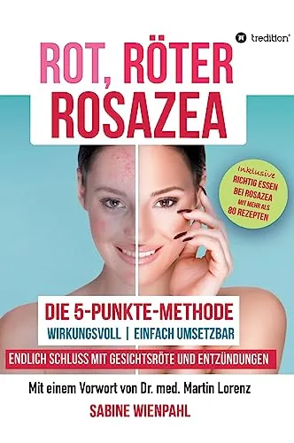 ROT RÖTER ROSAZEA: Die