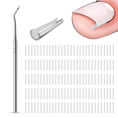 Stück Nagelspange Fußnägel,Eingewachsene Zehennagel Korrektur,Nagelfüller zur Korrektur von Zehennagel Eingewachsen,Korrigierende Pediküre-Werkzeuge für Die Fußpflege 150