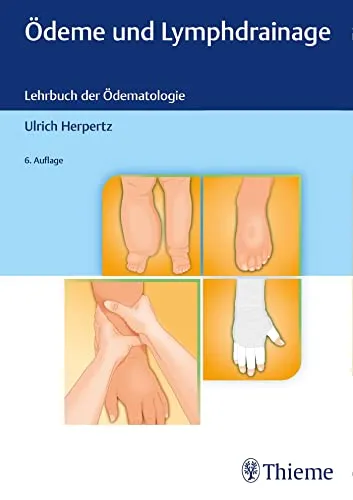 Ödeme und Lymphdrainage: Diagnose und Therapie - Medizin - Umfassende Anleitung zur Diagnose und effektiven Therapie von Ödemen durch Lymphdrainage-Techniken.