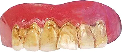 Schiefe gelbe Austin Powers Nerd Zähne mit Belag Kostüm-Zubehör falsches Gebiss Streber