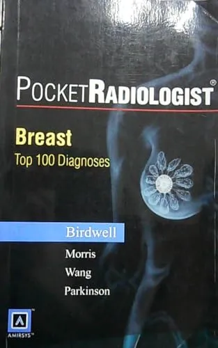 Breast Top 100 Diagnoses