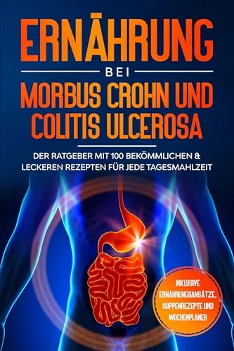 Ernährung bei Morbus Crohn und Colitis Ulcerosa: Der Ratgeber mit 100 bekömmlichen & leckeren Rezepten für jede Tagesmahlzeit - Inklusive Ernährungsansätze, Suppenrezepte und Wochenplaner