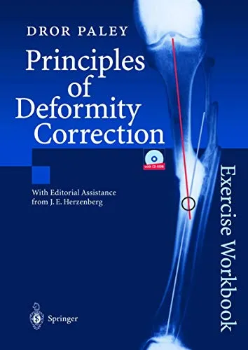 Principles of Deformity Correction Dror Paley