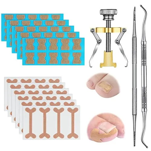 JBJXNXH 78 Stücke Eingewachsene Zehennägel Werkzeug Set,inklusiv Elastischer Patch Gebogene Zehennägel Klammer Aufkleber und Eingewachsener Korrektur Aufkleber,Zehennagel Feile und Heber