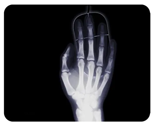 m. kern Mousepad Röntgen Hand