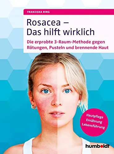 Rosacea – Das hilft wirklich: Die erprobte 3-Raum-Methode