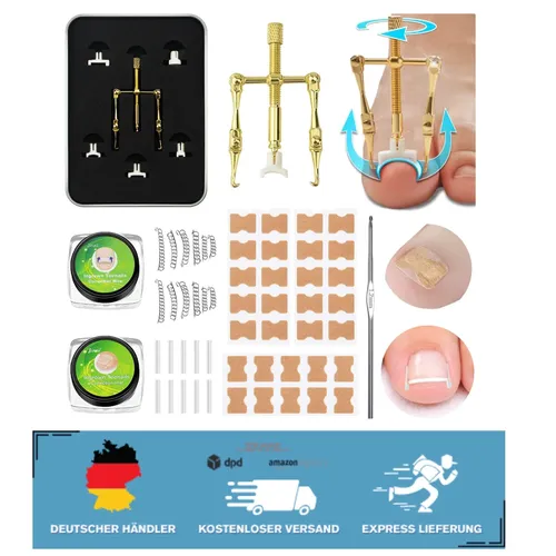 Produktbild Eingewachsene Zehennägel Korrektur-Set – Effiziente Lösungen für Fußgesundheit