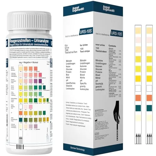 100 Urinstreifen Gesundheitstest mit 10 Indikatoren - Tests für Urintraktinfektionen – 10-in-1 Urinanalysestreifen für präzise Gesundheitsanalysen, schnelle Ergebnisse in 30-60 Sekunden und hohe Genauigkeit.