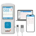 Produktbild: Pulox PM10 Mobiles Einkanal EKG-Gerät - Wireless EKG-Monitor für Zuhause mit Analyse, Smartphone-App & PC-Software