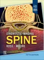 Produktbild: Diagnostic Imaging: Spine