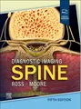 Produktbild: Diagnostic Imaging: Spine Jeffrey S. Ross