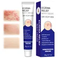 Produktbild: 20g Ekzem Creme,HautPflege creme,Anti Juckreiz Creme,Feuchtigkeitsspendende Salbe,lindert für trockene Haut,verbessert das Hautgefühl,schnell einziehend