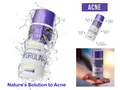Produktbild: Lavender water with anti-acne effect -150 ml, 100% Organic Natural Product INA