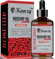Produktbild: Kanzy Hagebuttenöl Bio Kaltgepresst 100% Rein 50ml Rosehip Oil Wildrosenöl für Haut Haare Nägel Gesichtsöl Körperöl Vegan Hexanfreies Hagebuttenkernöl Anti-Aging Anti-Falten Natürlich