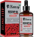 Produktbild: Hagebuttenöl Bio Kaltgepresst 100% Rein 50ml Rosehip Oil Wildrosenöl für Haut...