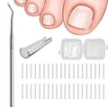 Produktbild: 40 Pcs Eingewachsene Zehennägel Set Zehennagel Korrektur Zehennagel Korrektur...