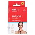 Produktbild: AKNE PATCH Hydrocolloid 3 Größen 24 St.