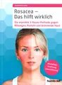 Produktbild: Rosacea - Das hilft wirklich von Franziska Ring (2022, Taschenbuch)