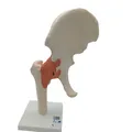 Produktbild: 3B Scientific Menschliche Anatomie A81 - Hüftgelenk-Funktionsmodell